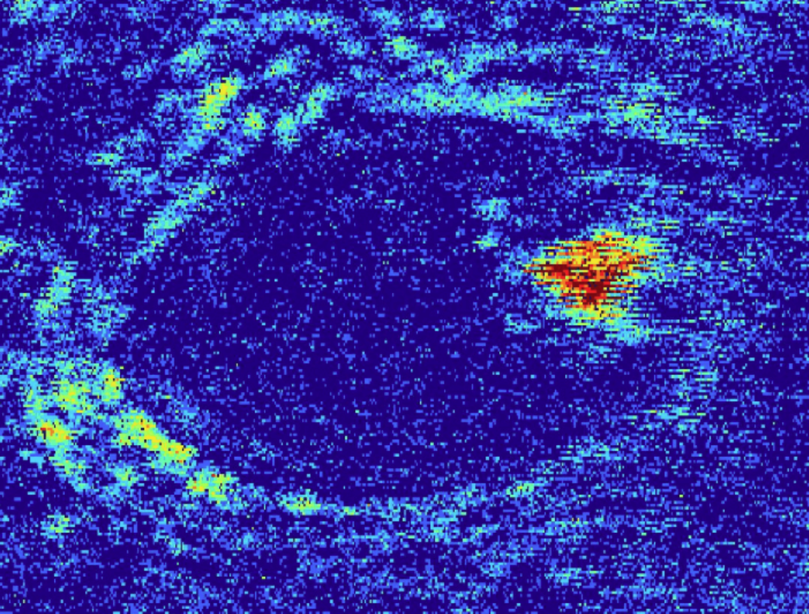 An Antral Follicle with visible Oocyte.
